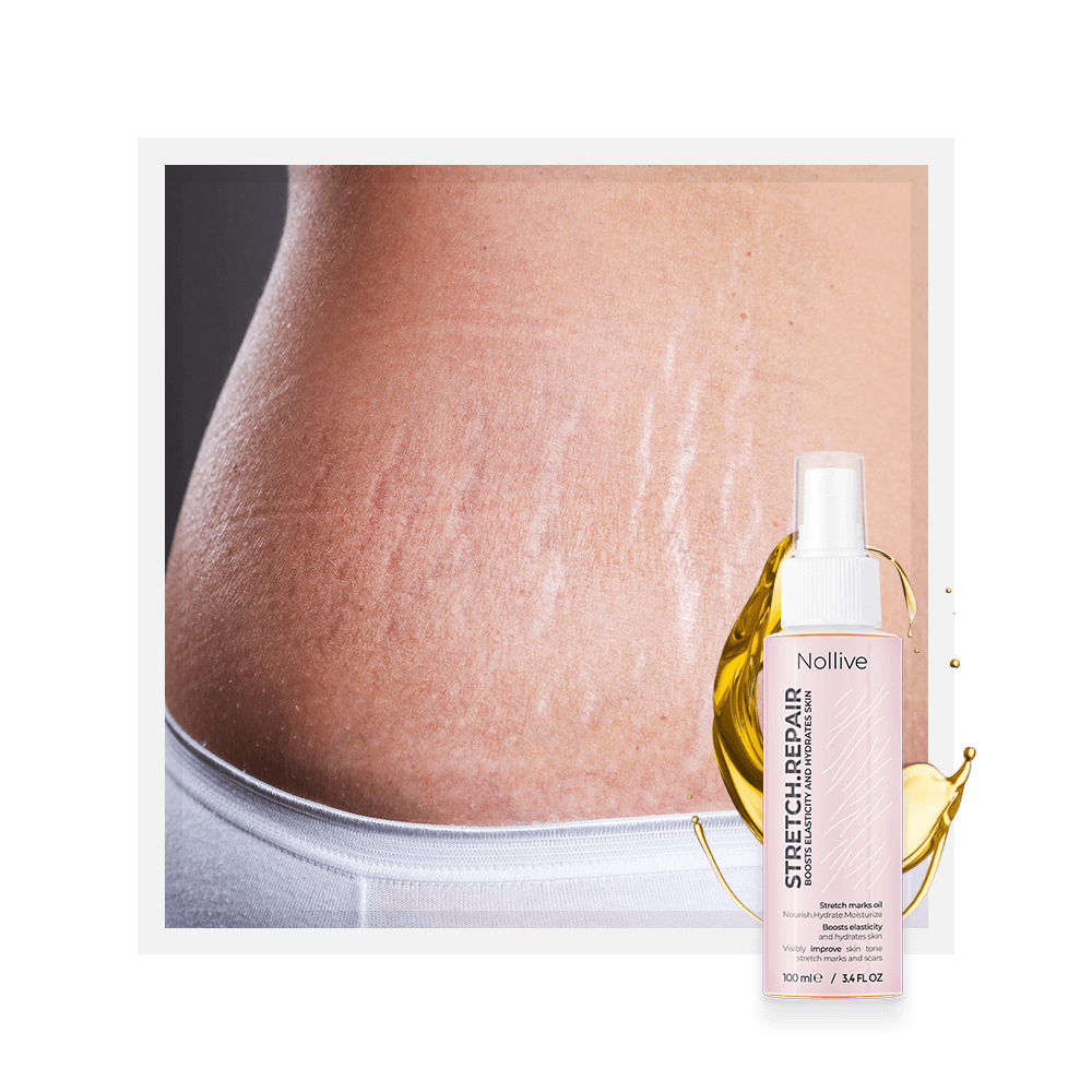 Ulei Antivergeturi: Stretch.Repair