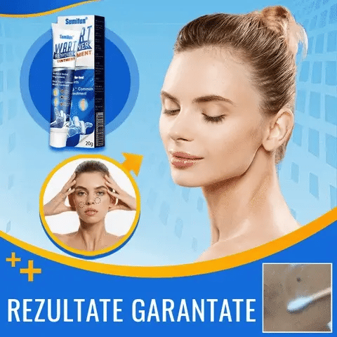 ClearSkin WartOff Cream – Eliminare Rapidă a Negilor și Imperfecțiunilor Pielea Fără Durere